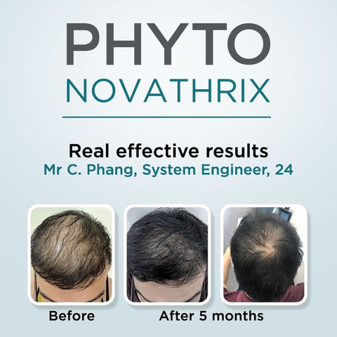Phytonovathrix Award Winning Anti Hair Loss & Scalp Treatment 12x3.5ml for Men & Women for Hair Regrowth